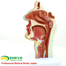 THROAT04(12508) Pathology Nasal Cavity Section Model, Full Size, Ear-Eye-Nose-Throat Models > Nasal Cavity Models